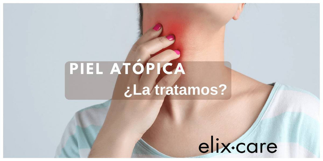 piel atópica: imagen mujer con eccema en el cuello