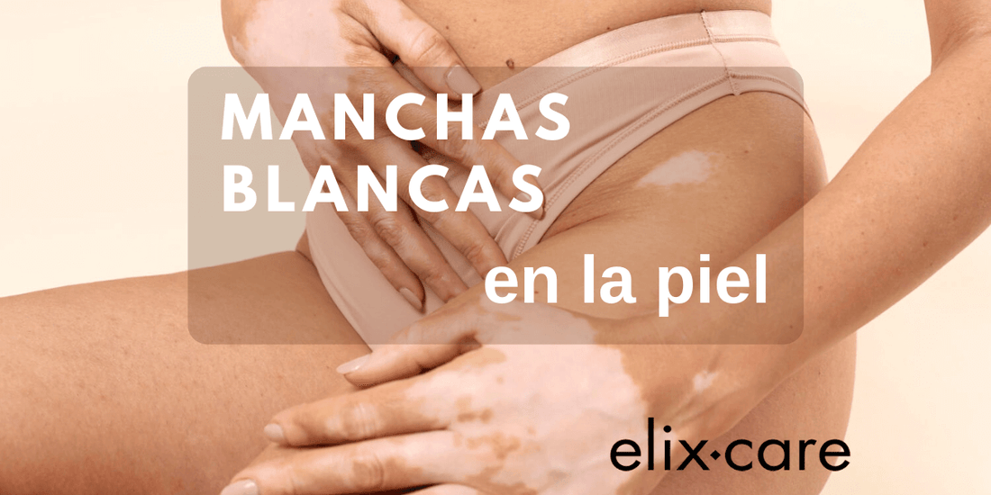 Manchas Blancas en la Piel razones