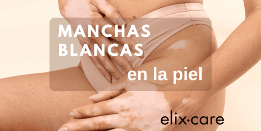 Manchas Blancas en la Piel razones