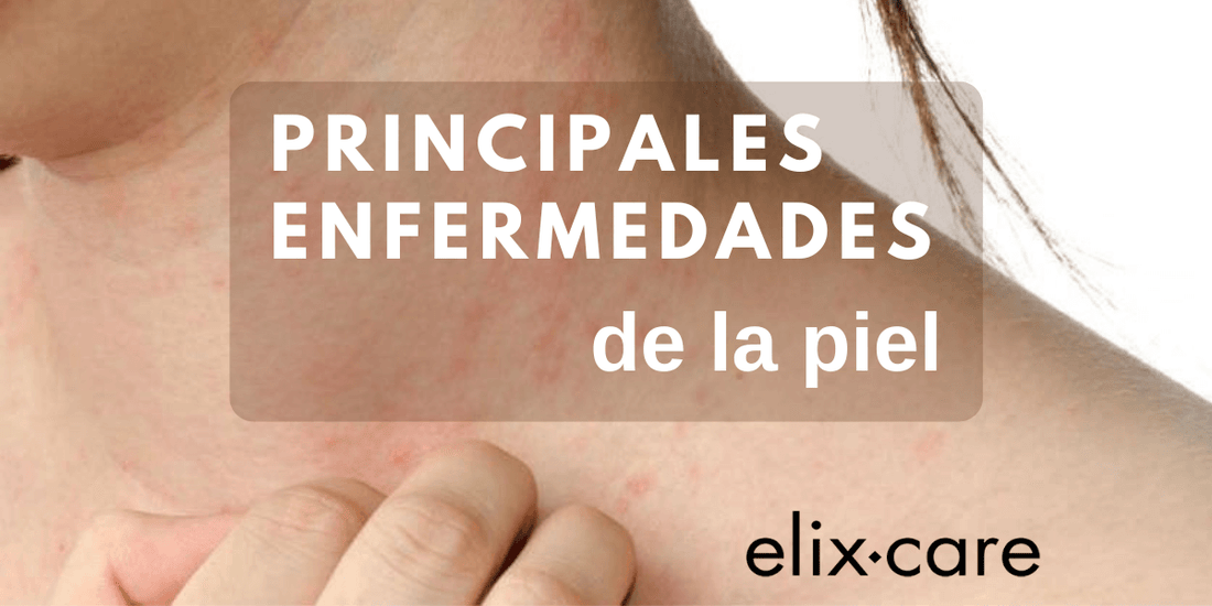 principales enfermedades de la piel