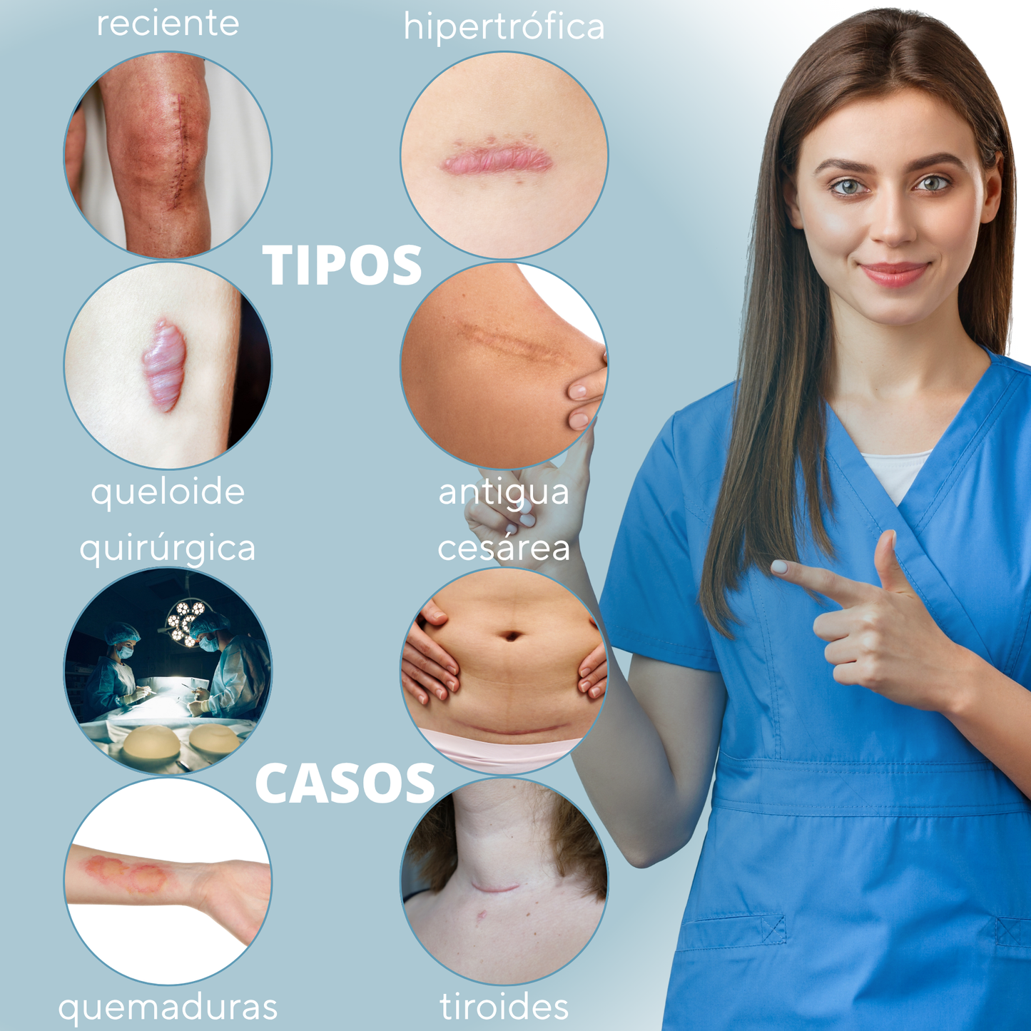 parches para cicatrices cesárea, tiroides, quiréurgicas, queloides, recientes, hipertróficas, quemaduras, niños