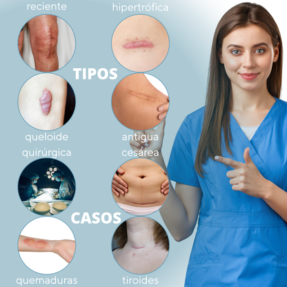parches para cicatrices cesárea, tiroides, quiréurgicas, queloides, recientes, hipertróficas, quemaduras, niños